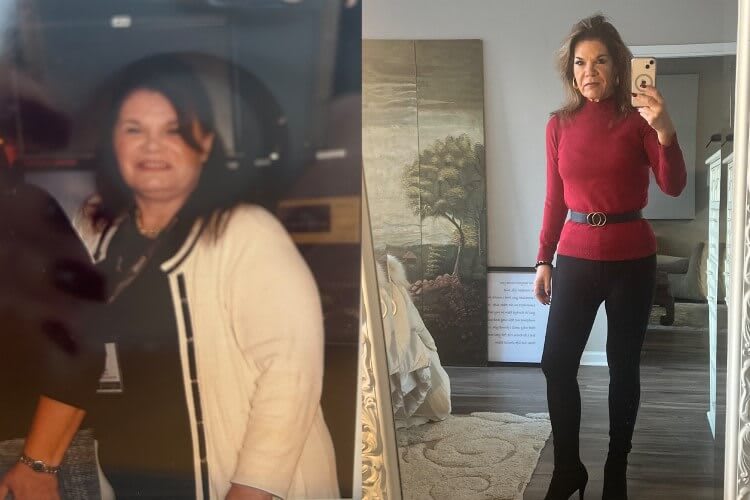 Debra Smith Before After