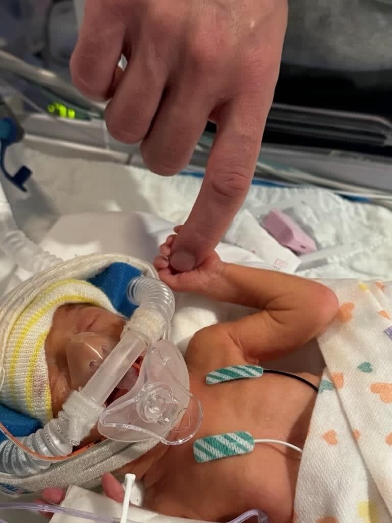 baby in nicu