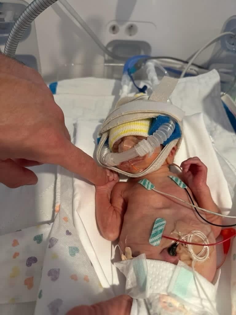 baby in nicu