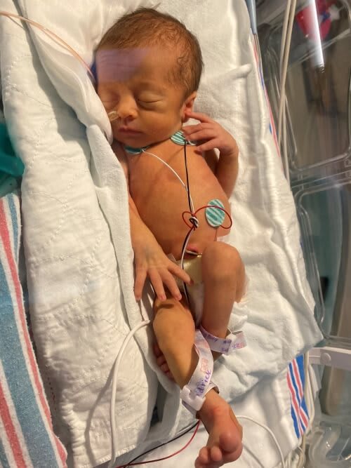 a baby in the nicu