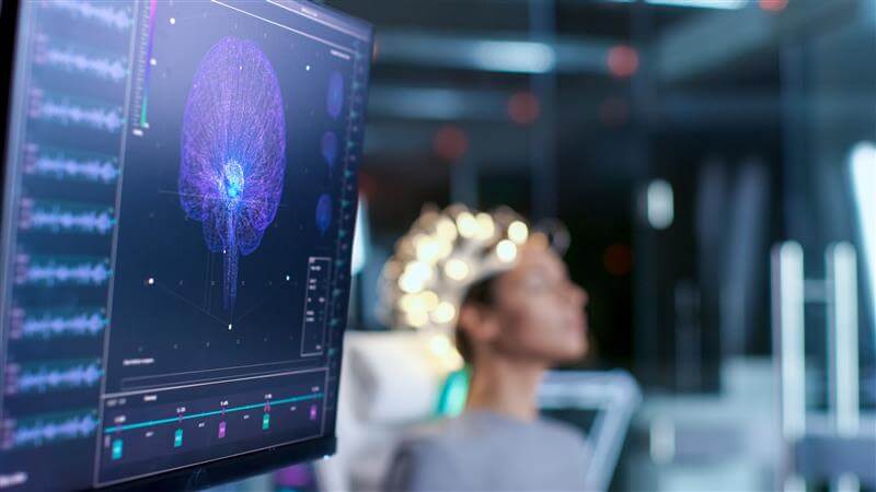 Brain scan displayed on a screen