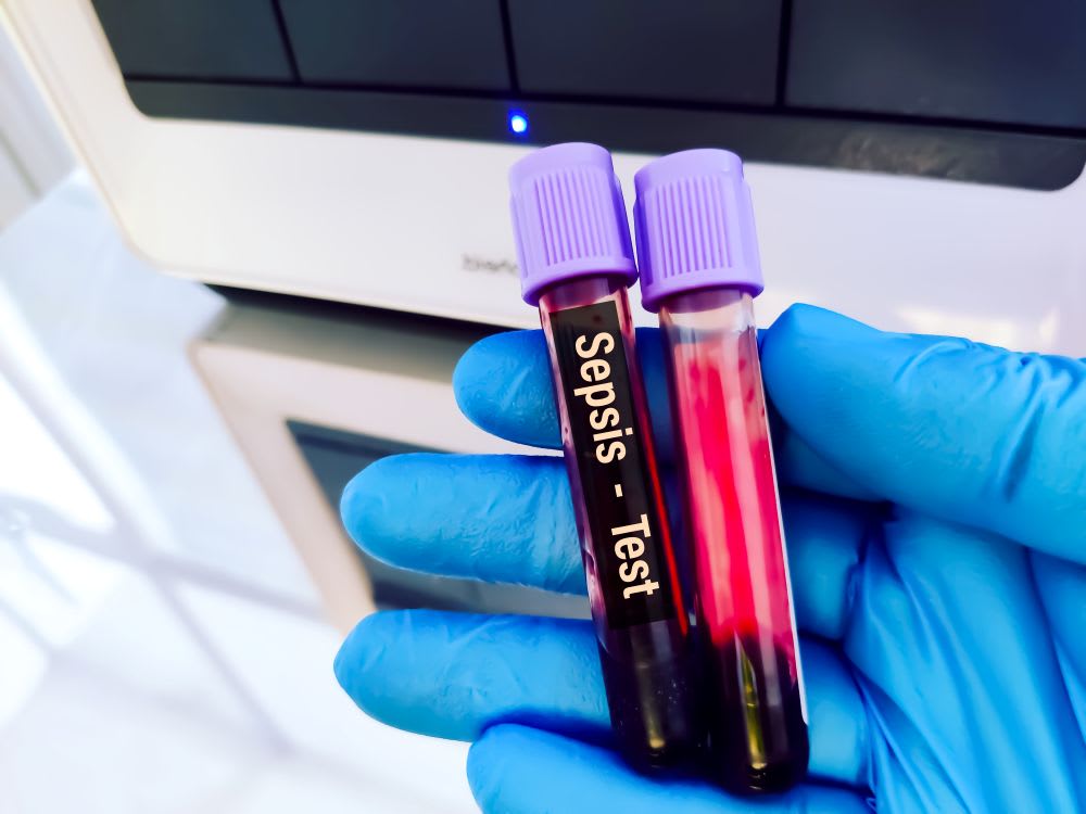 blood vials