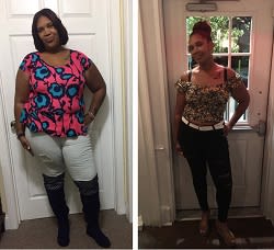 ShanteeRazorBariatricStory250x228